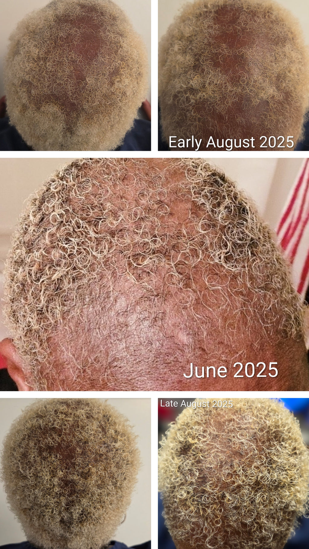 Natural Multi-Oil Blend for Hair & Scalp Growth Support | Rosemary, Argan, Jojoba